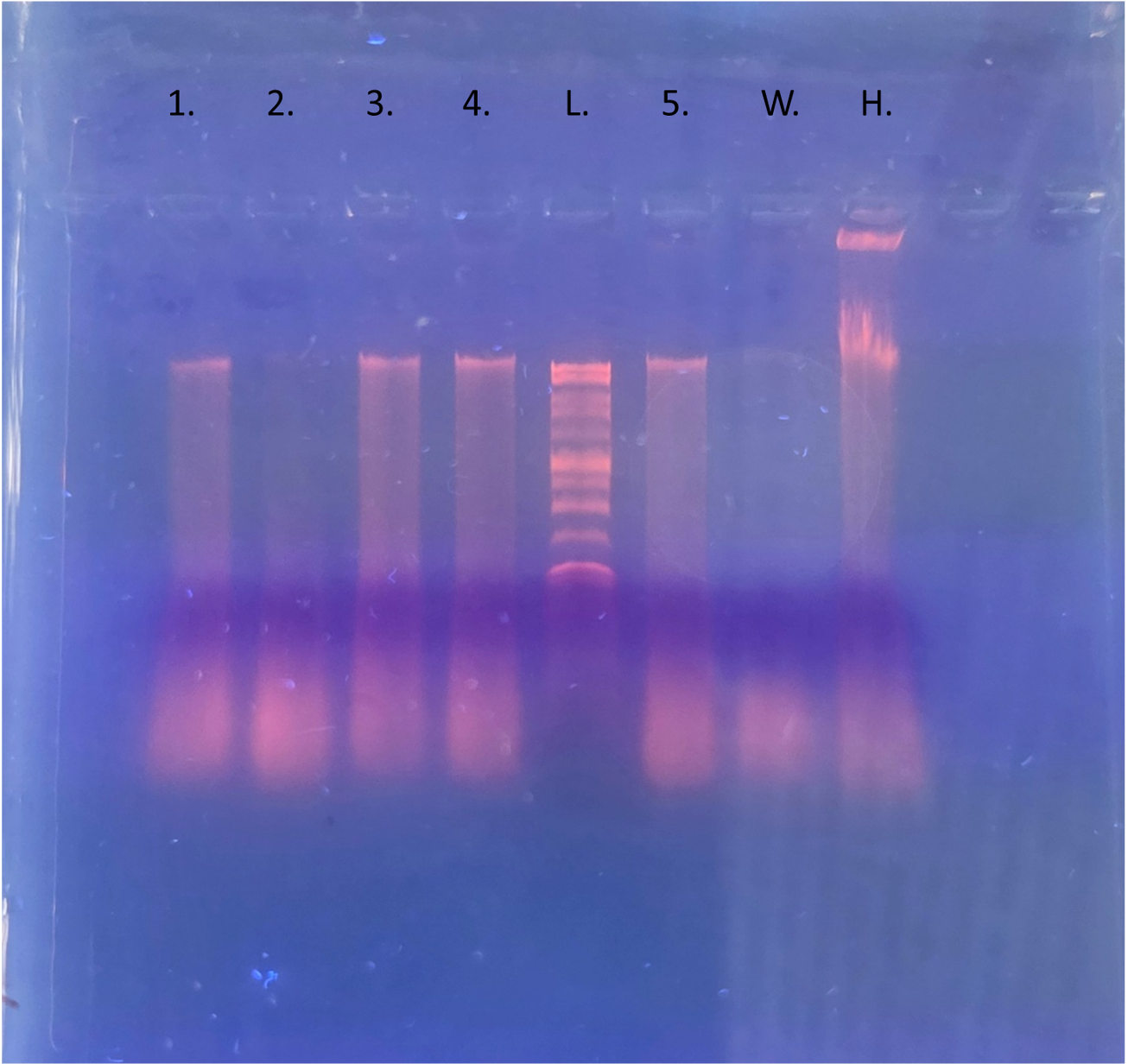 Extracted DNA